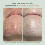 Cloud Repair Moisturiser