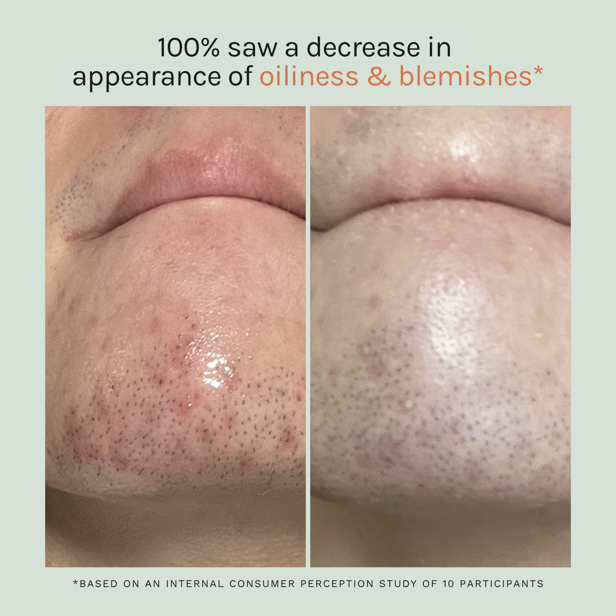 Cloud Repair Moisturiser